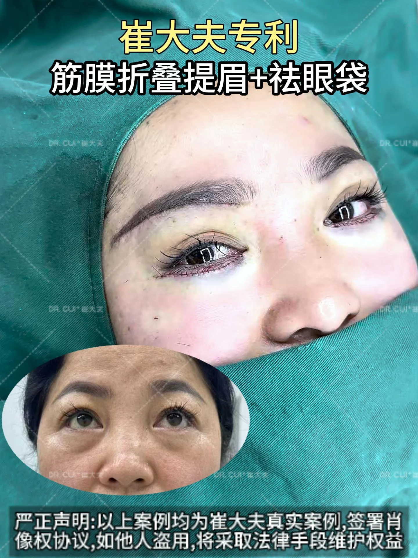 对比 (1)