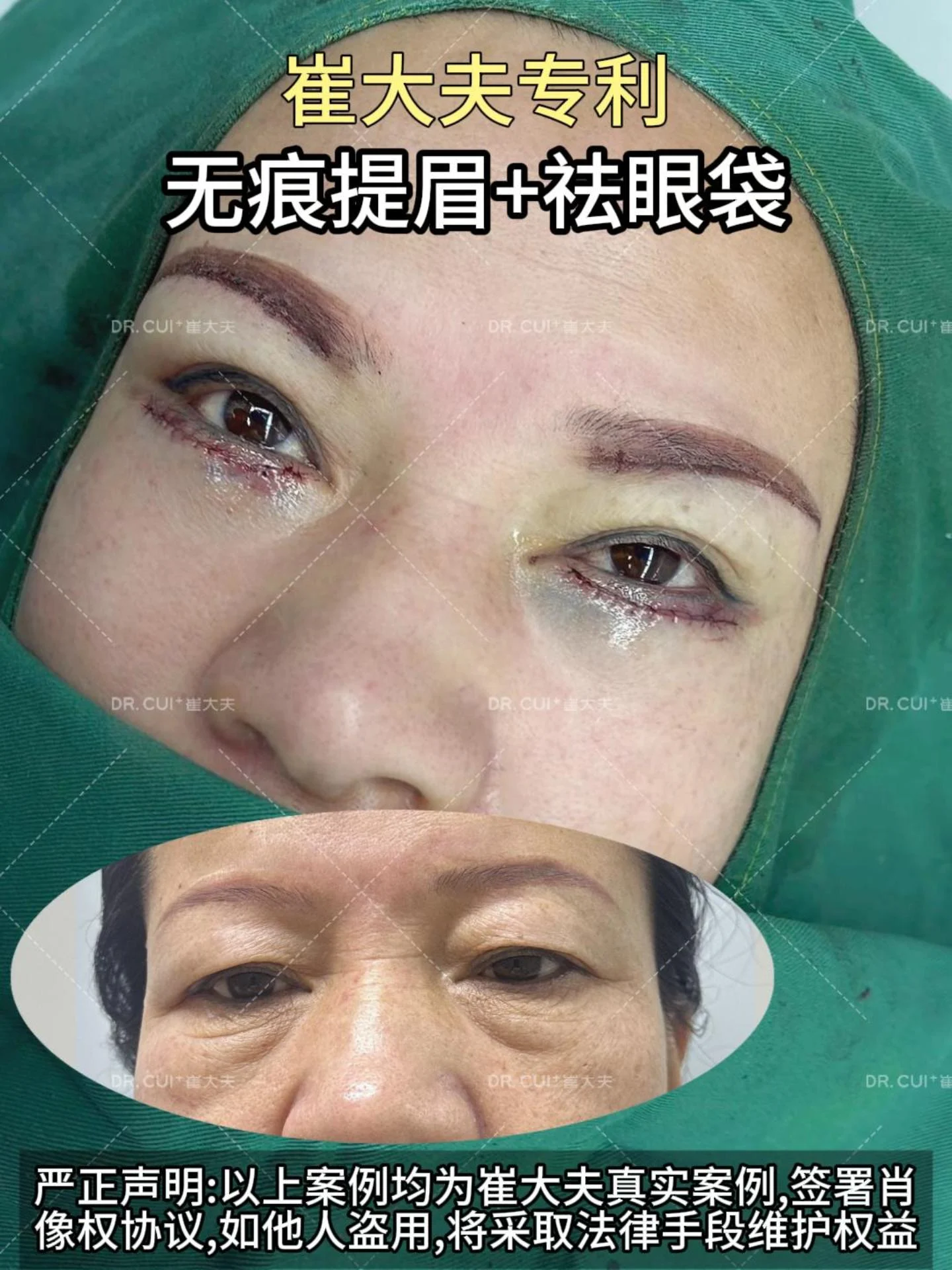 对比 (2)