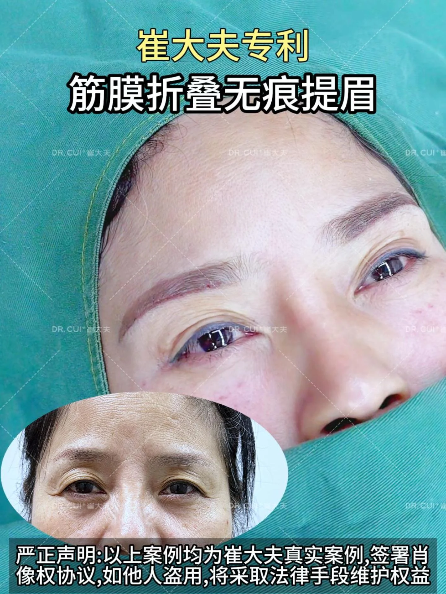 对比 (3)
