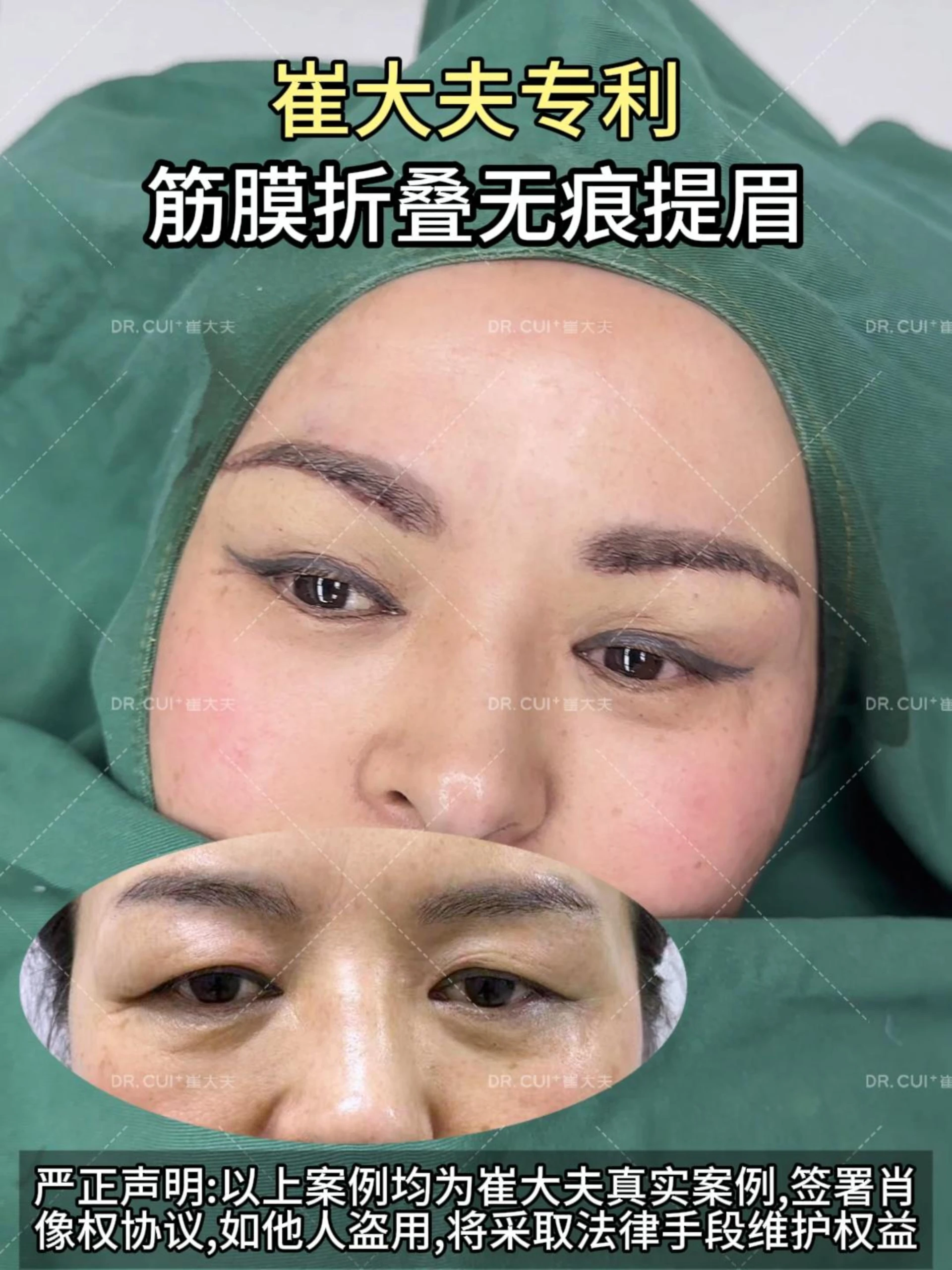 对比 (4)