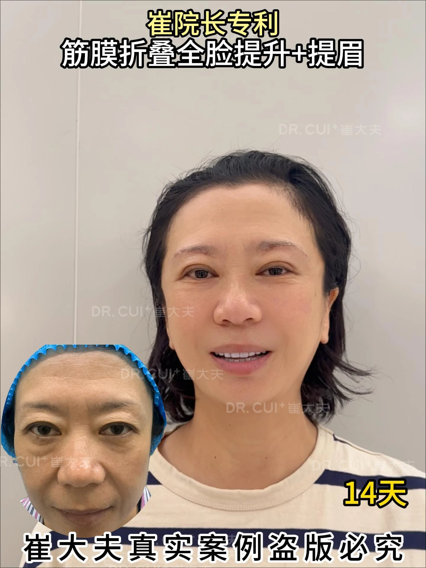 对比 (10)