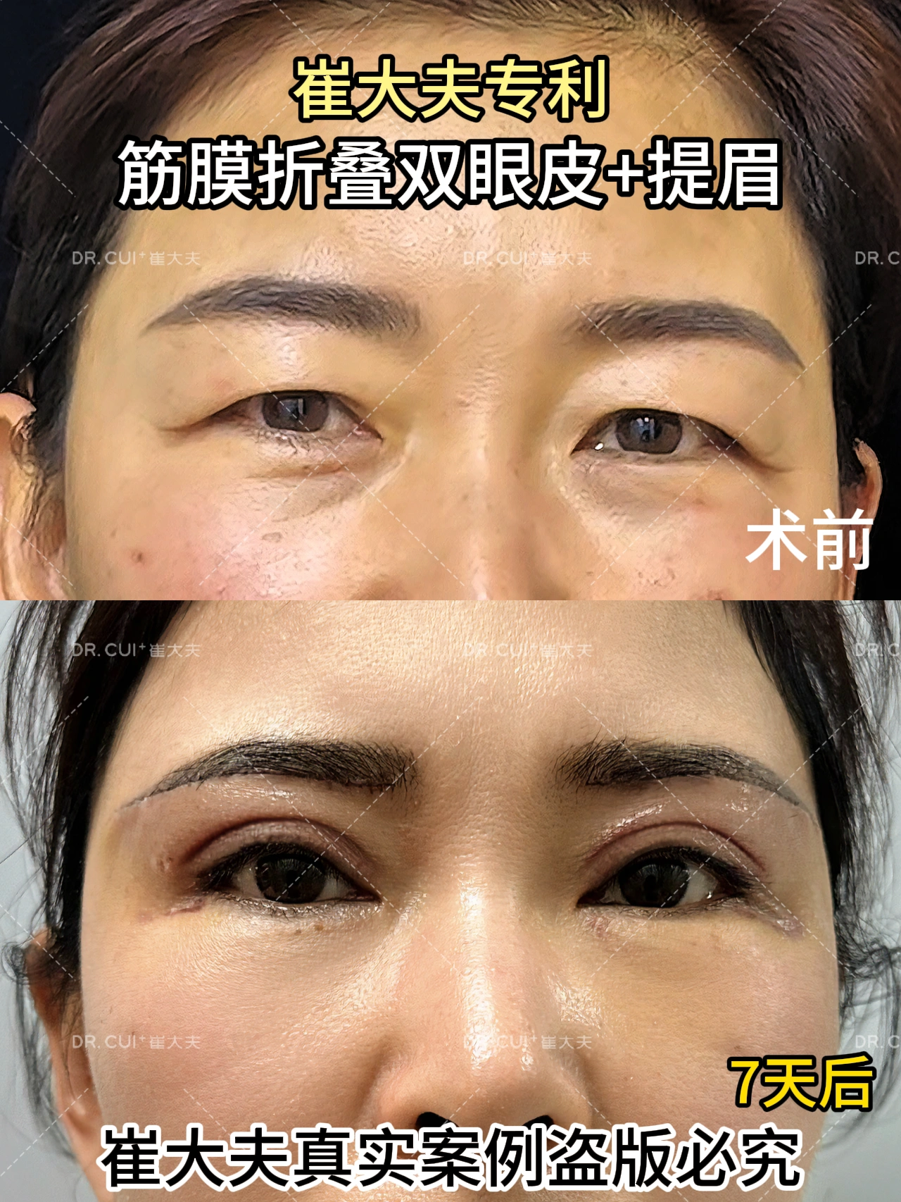 对比 (12)