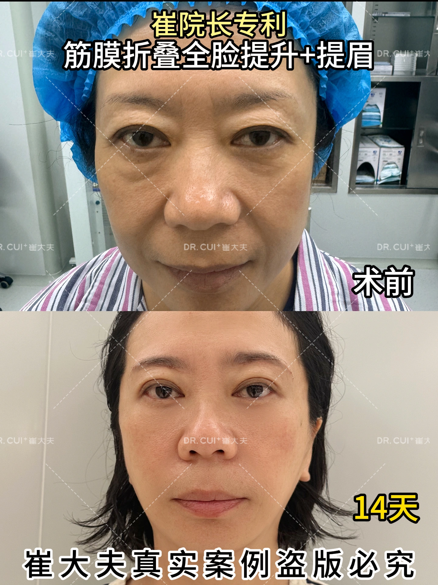 对比 (11)