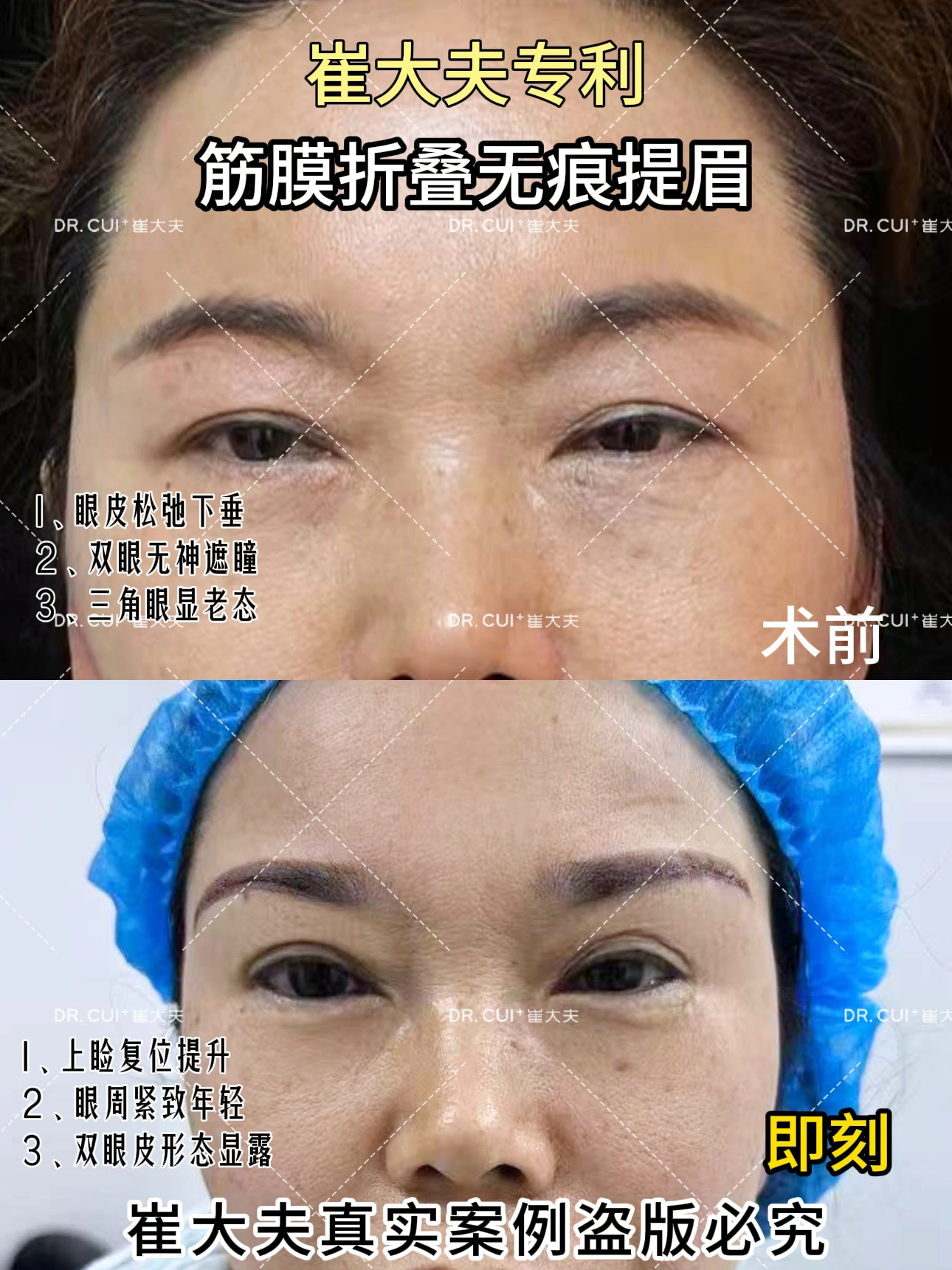 对比 (13)