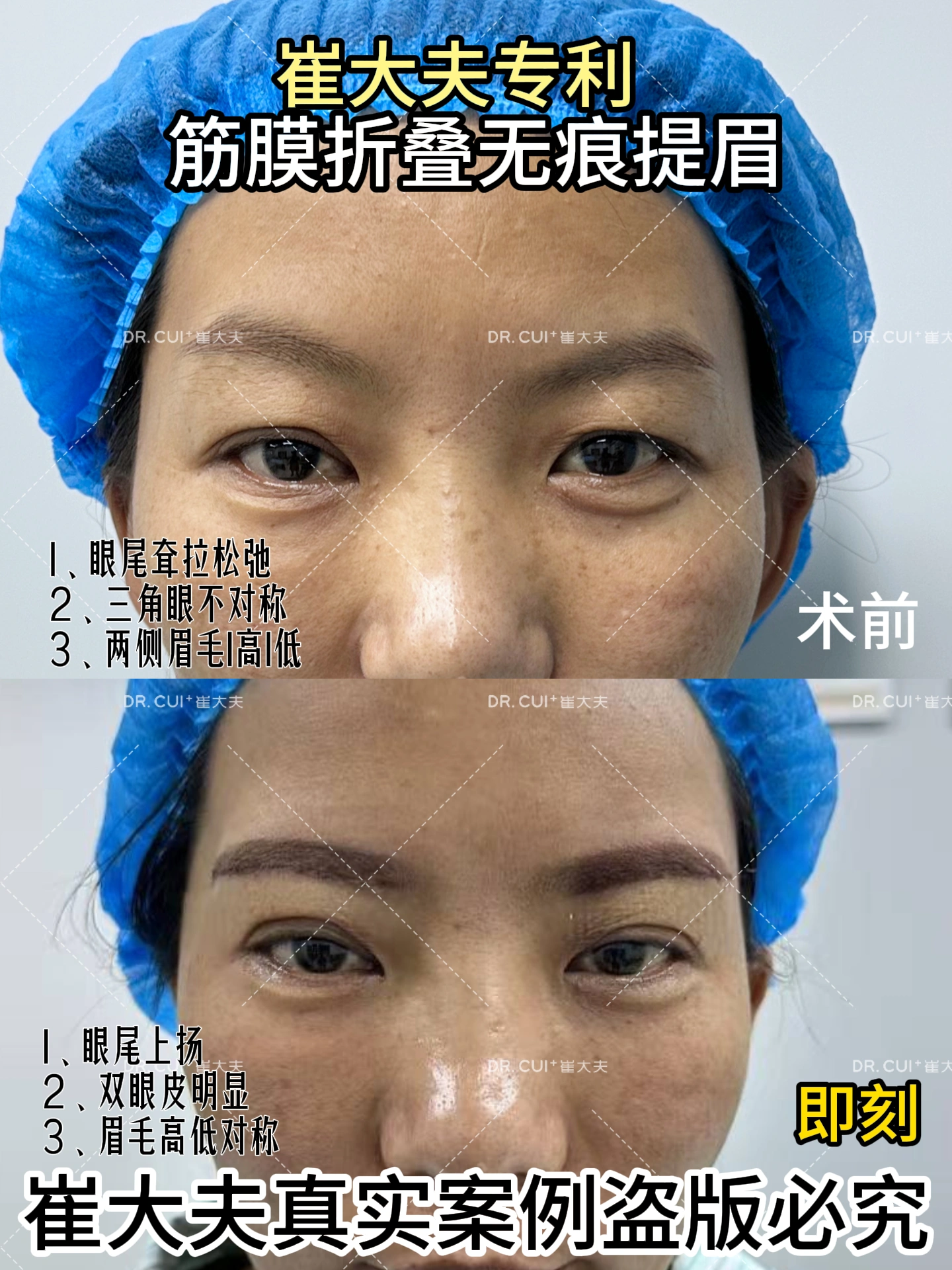 对比 (14)