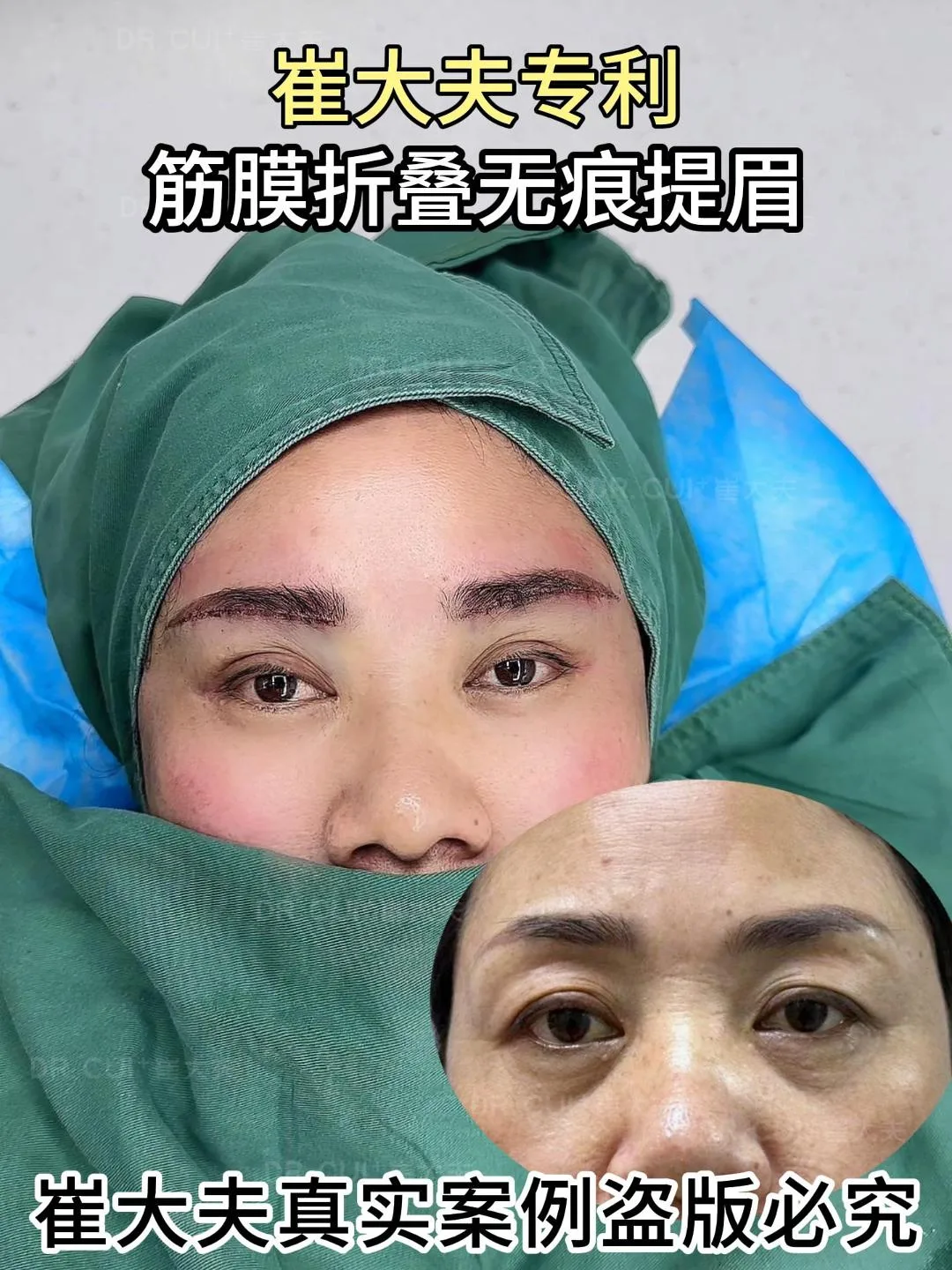 对比 (15)