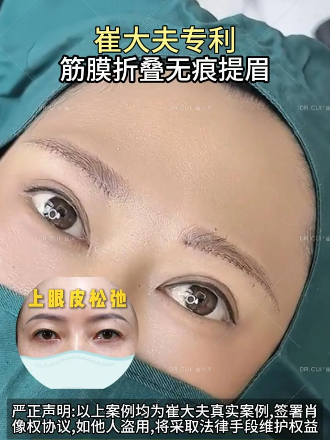 对比 (16)