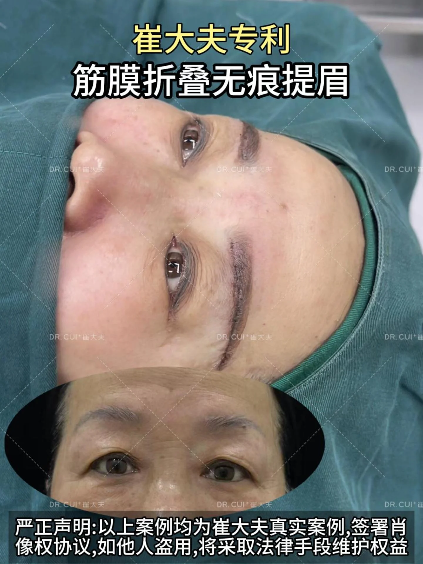 对比 (17)
