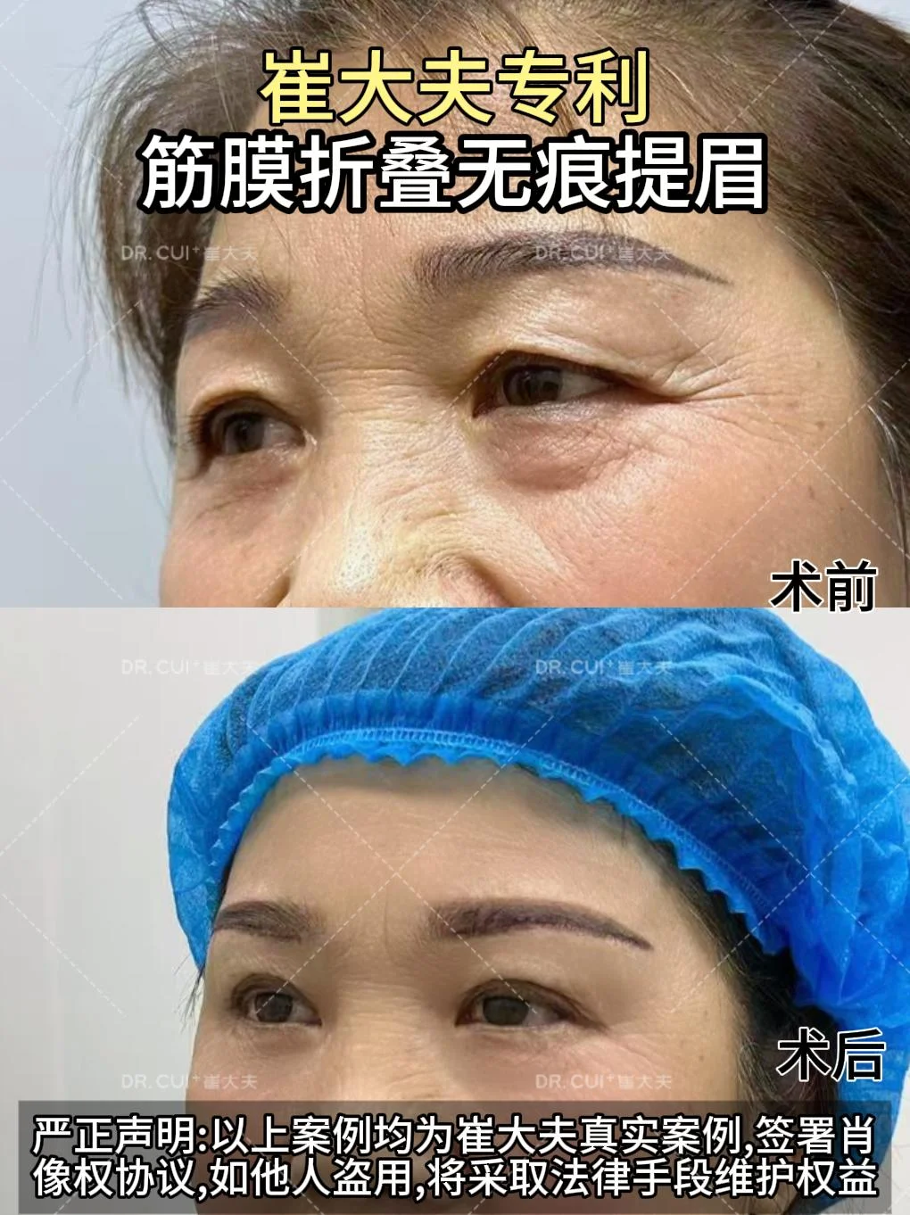 对比 (18)