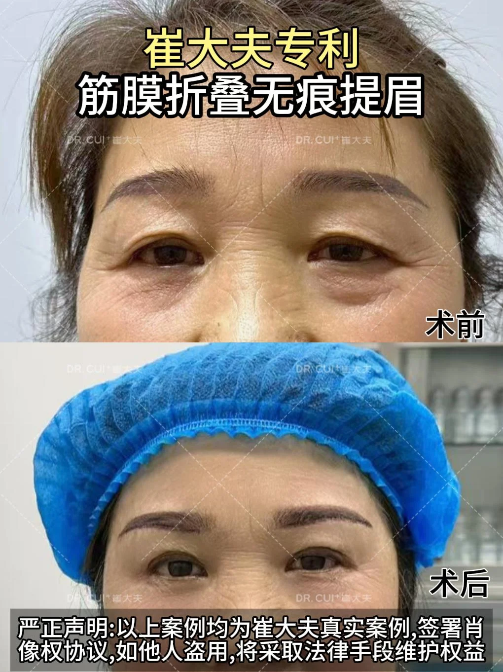 对比 (19)