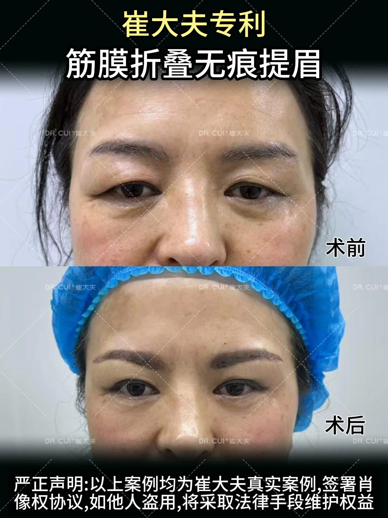 对比 (20)
