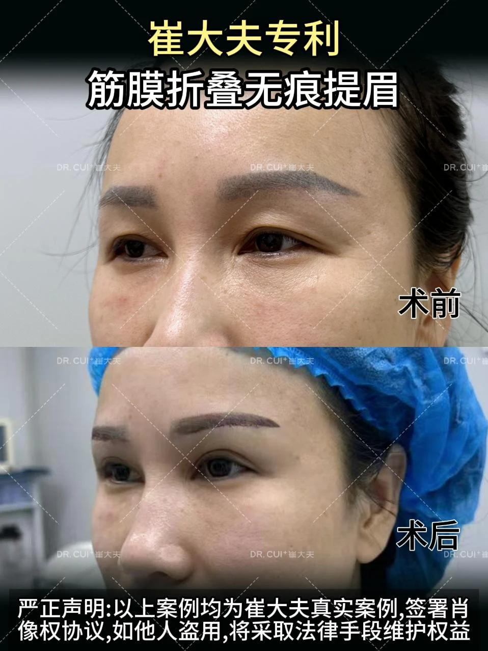 对比 (21)