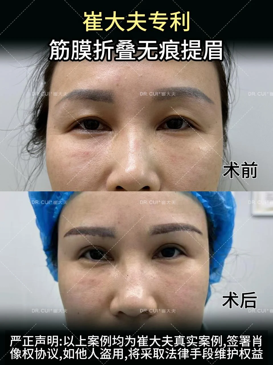 对比 (22)