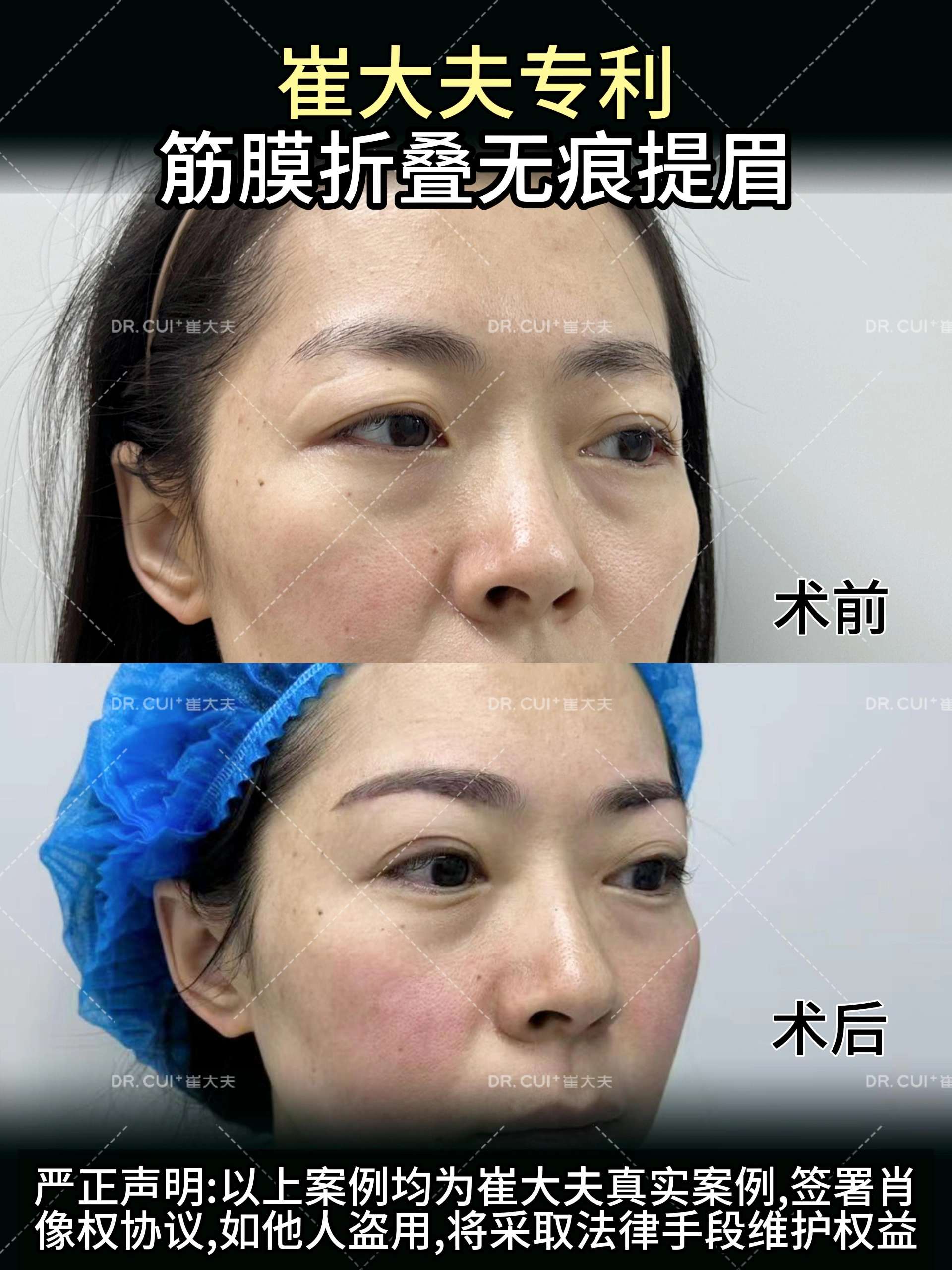 对比 (23)