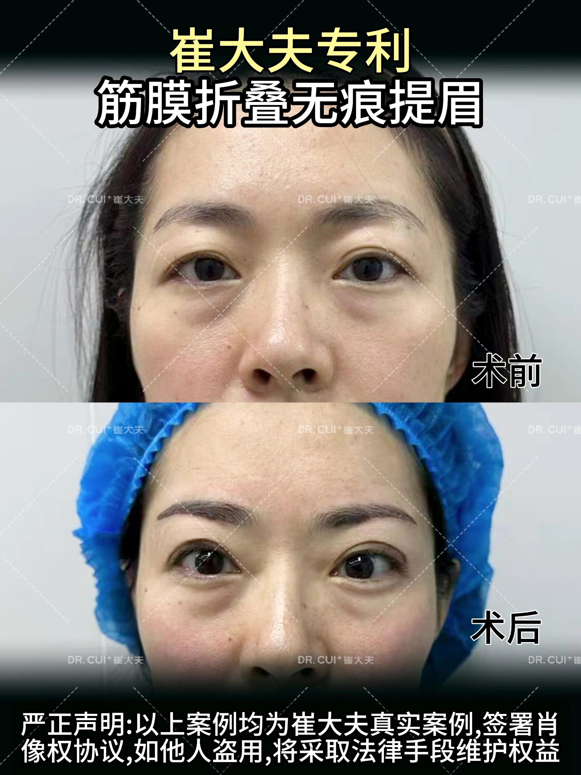 对比 (24)