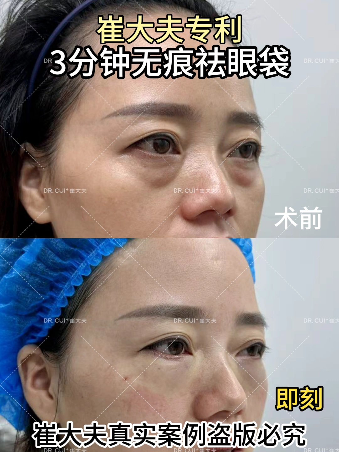 对比 (1)
