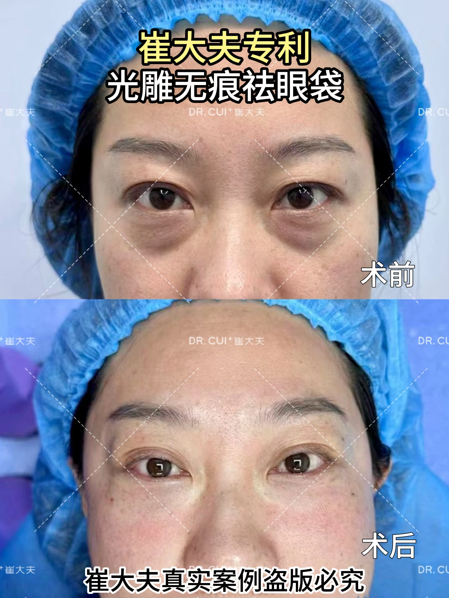 对比 (3)