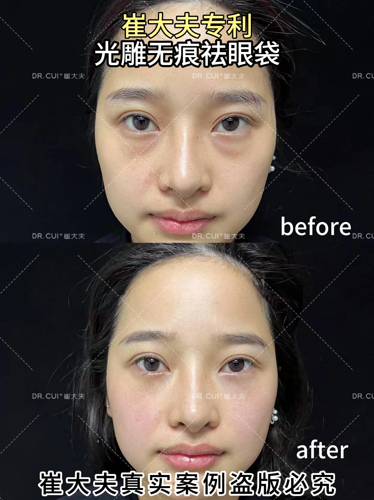 对比 (4)
