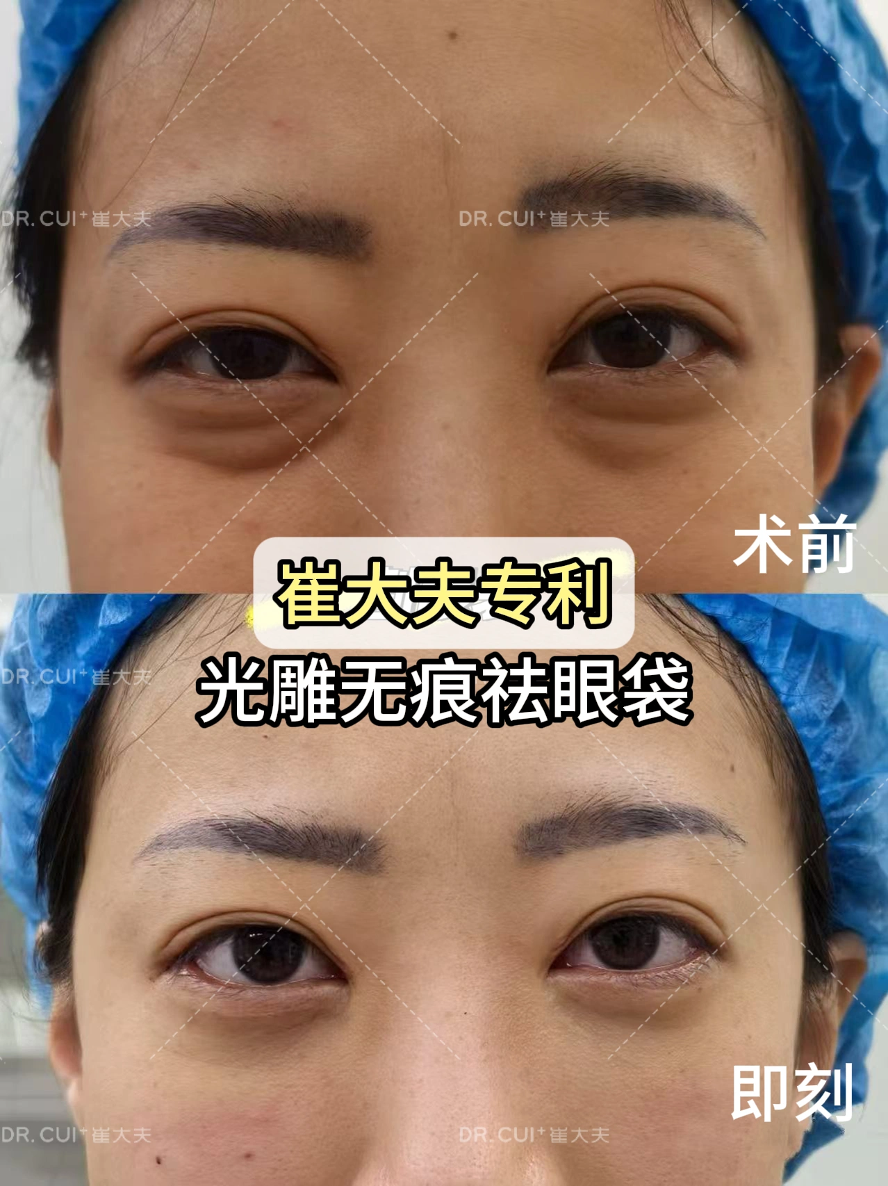 对比 (5)