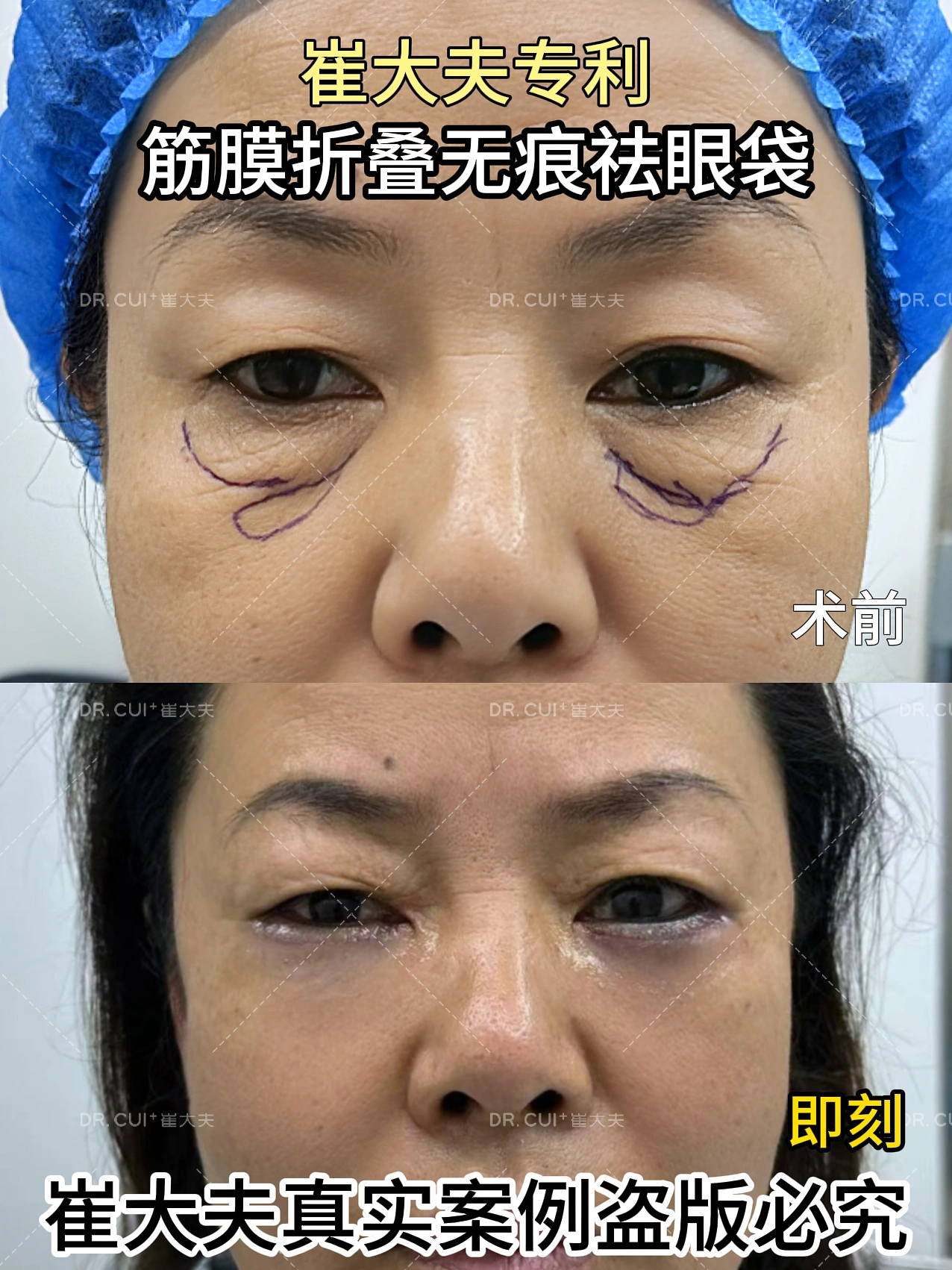 对比 (9)