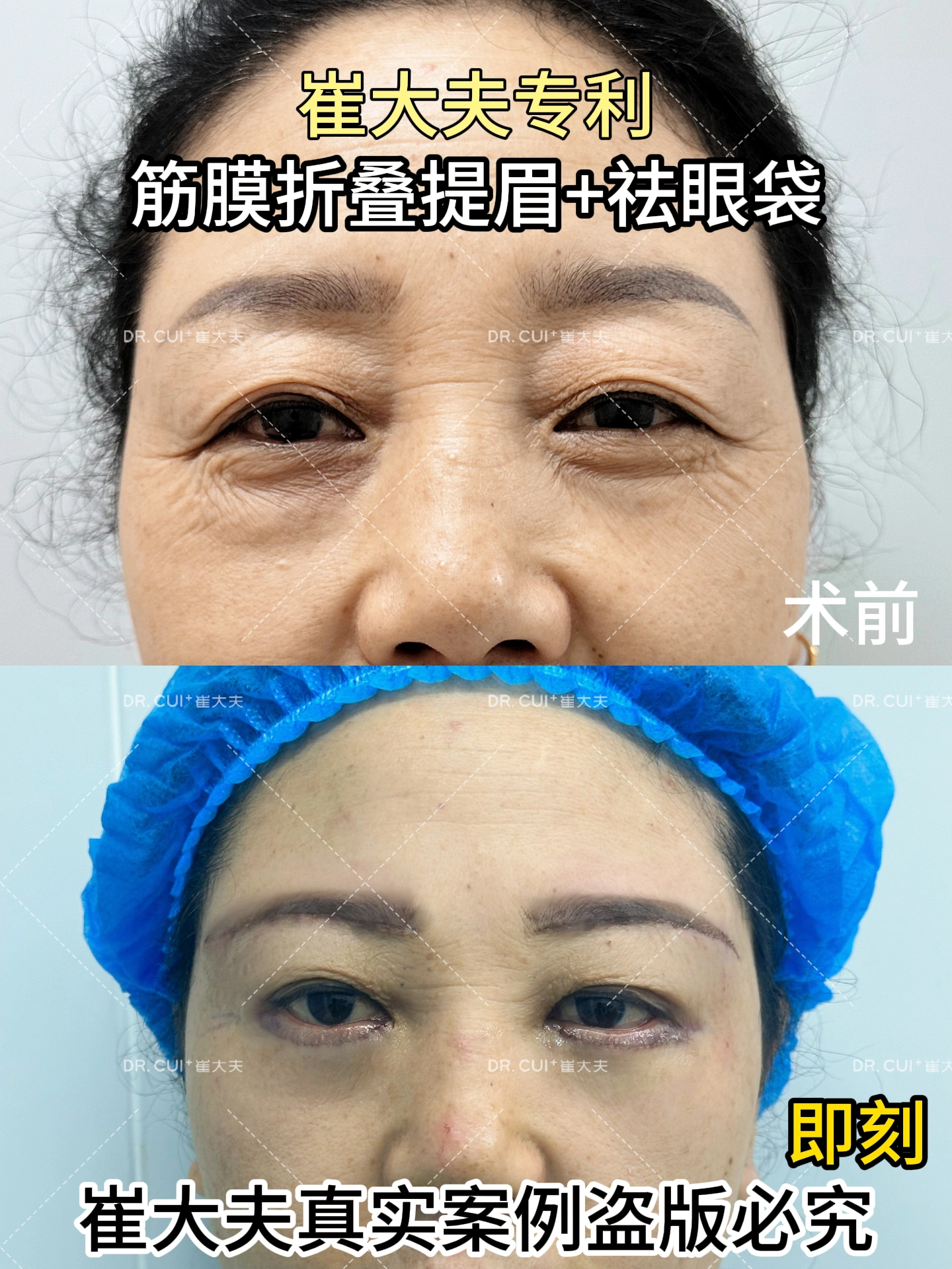 对比 (8)