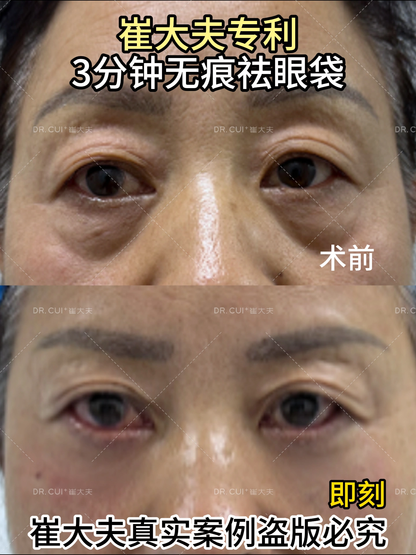 对比 (10)