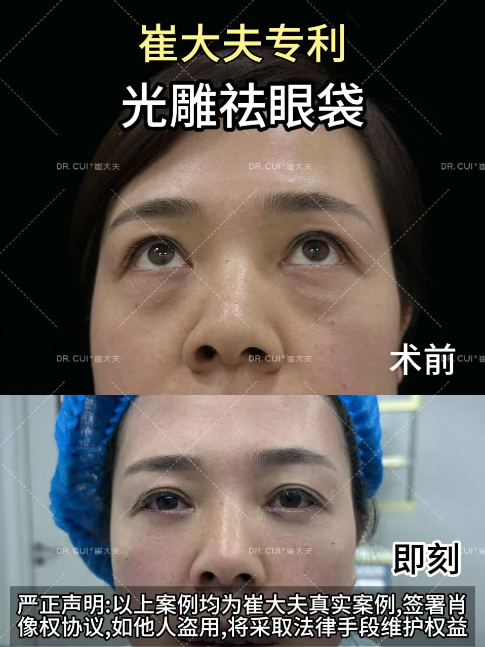 对比 (11)