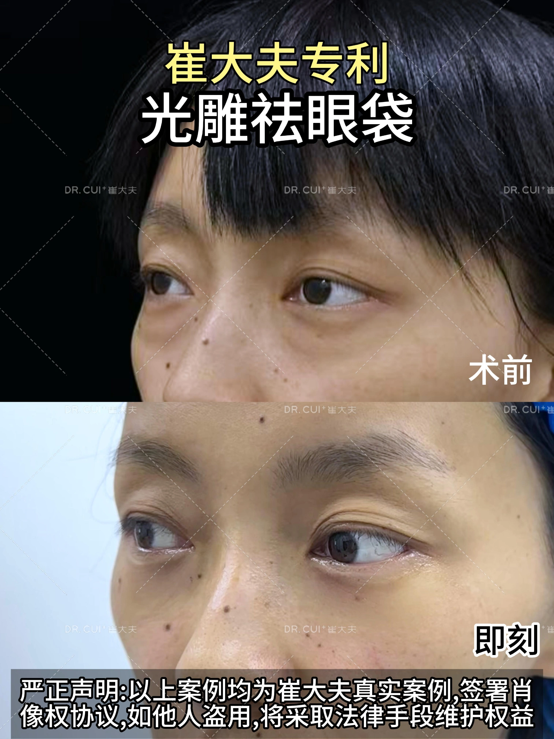 对比 (12)