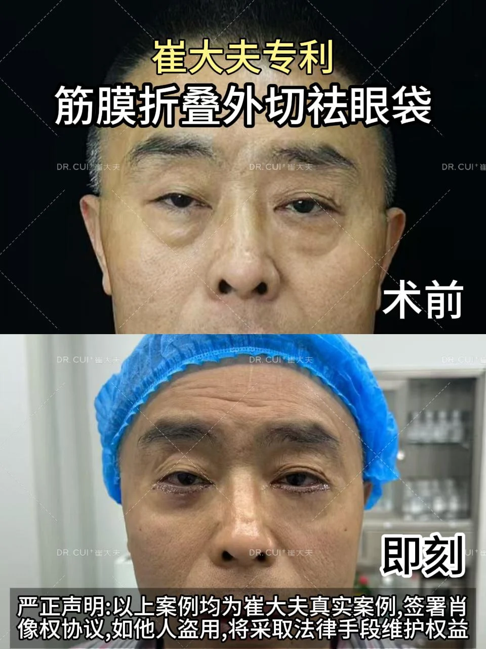 对比 (14)