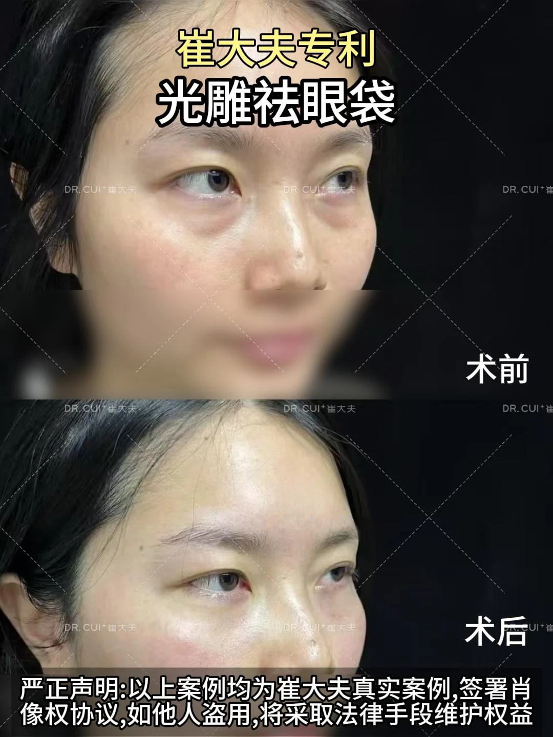 对比 (16)