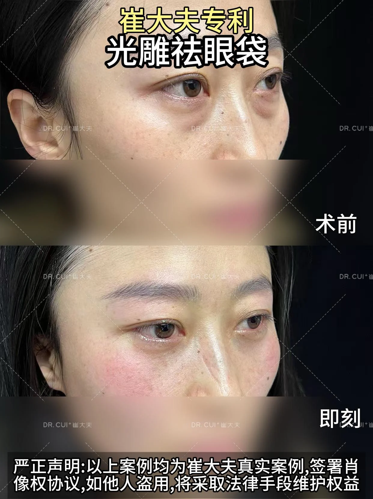 对比 (15)