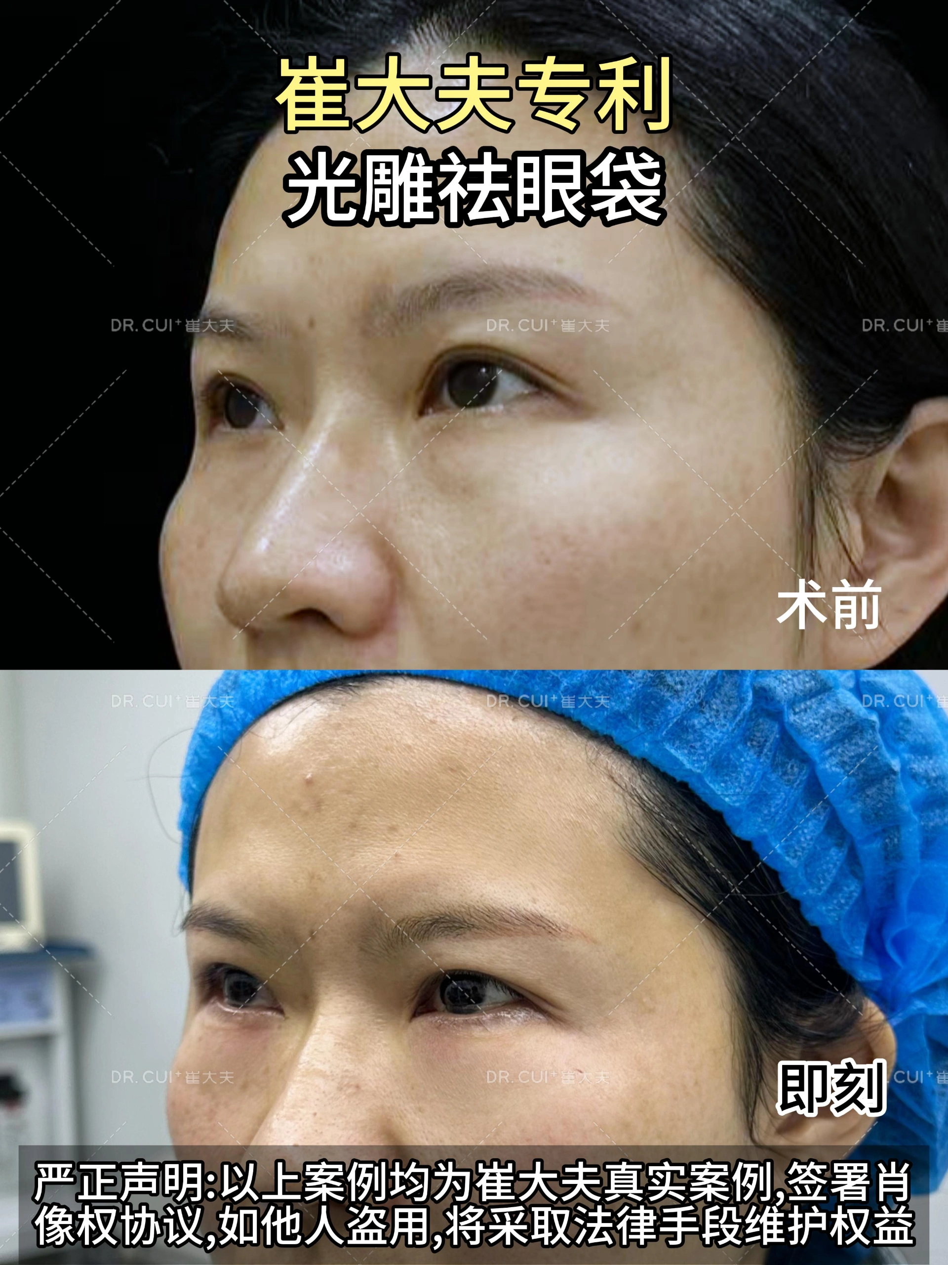 对比 (17)