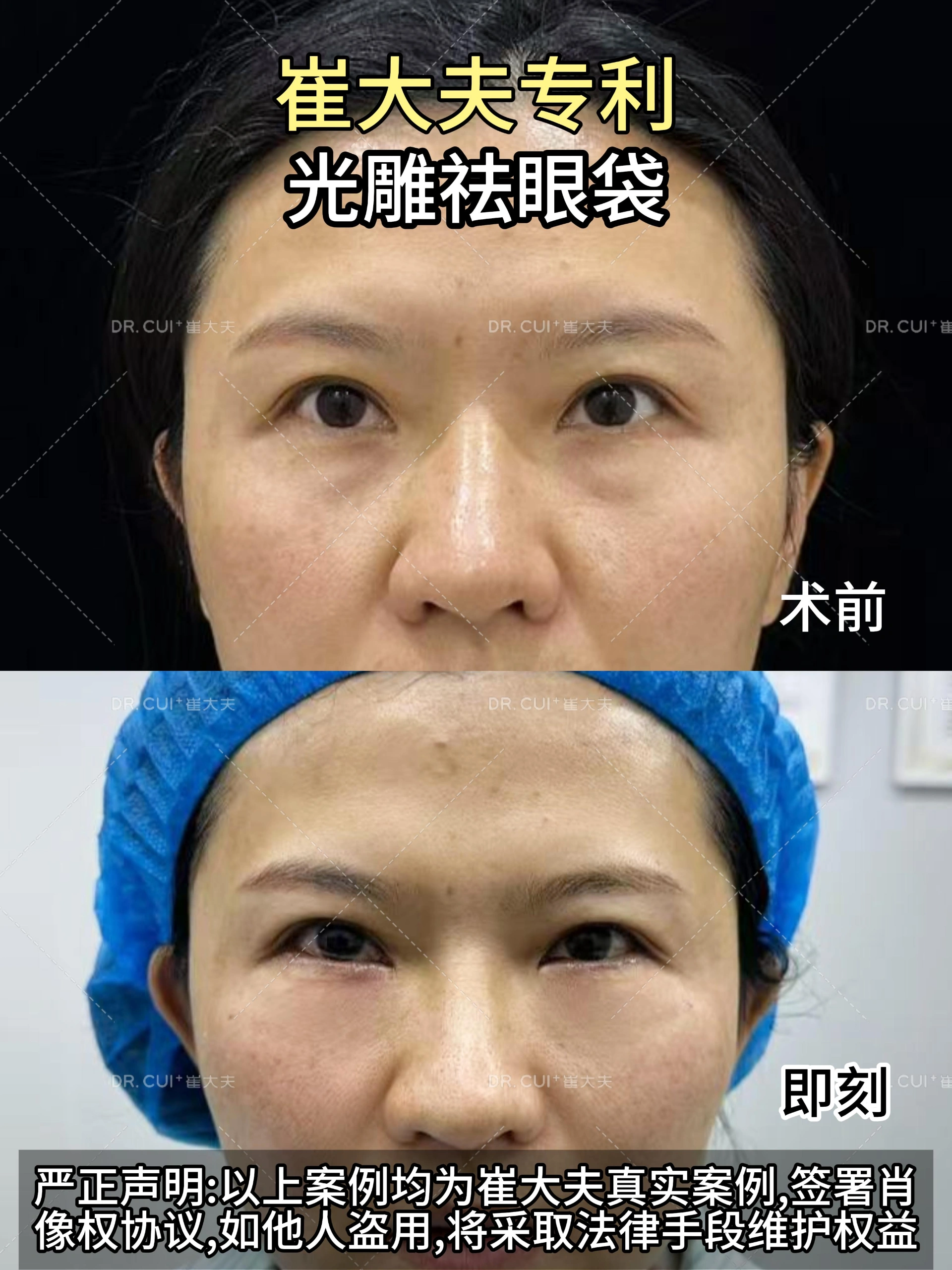 对比 (18)