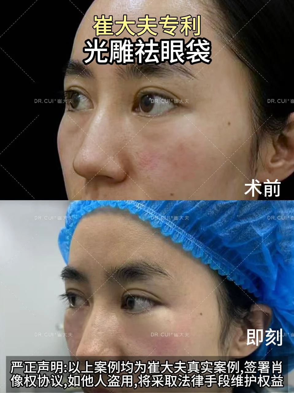 对比 (19)