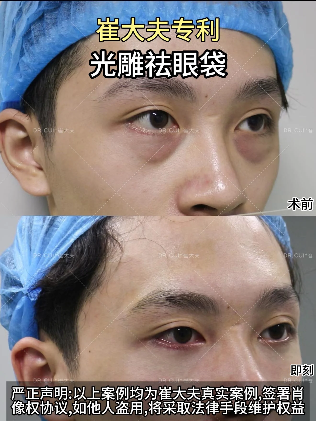 对比 (20)