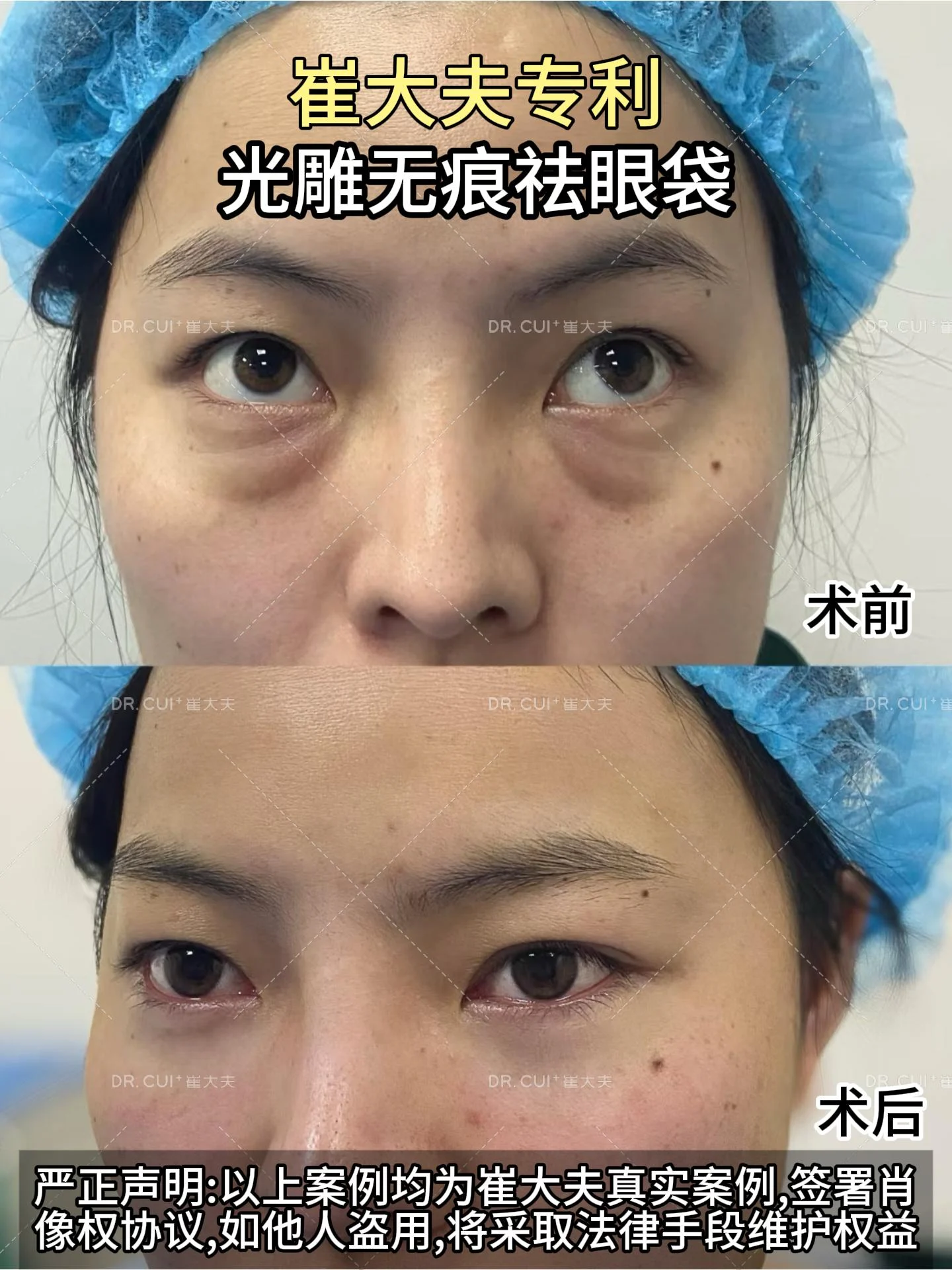 对比 (21)