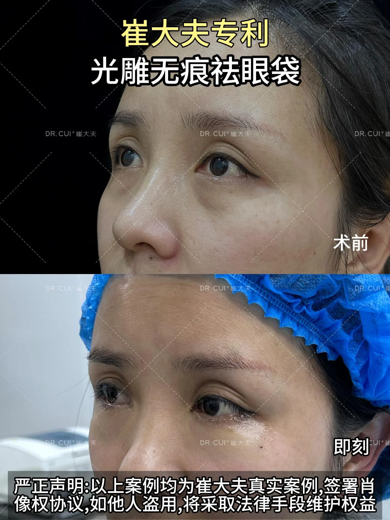 对比 (22)