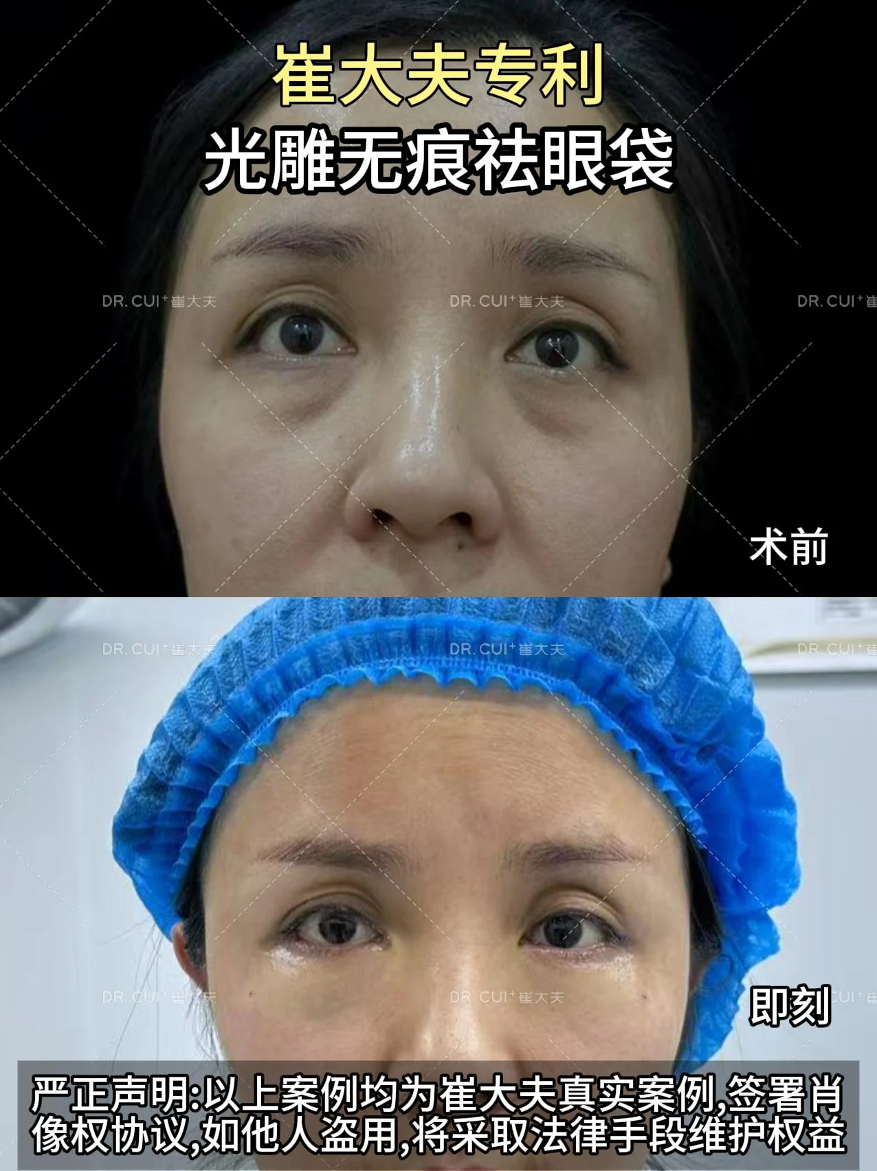 对比 (23)