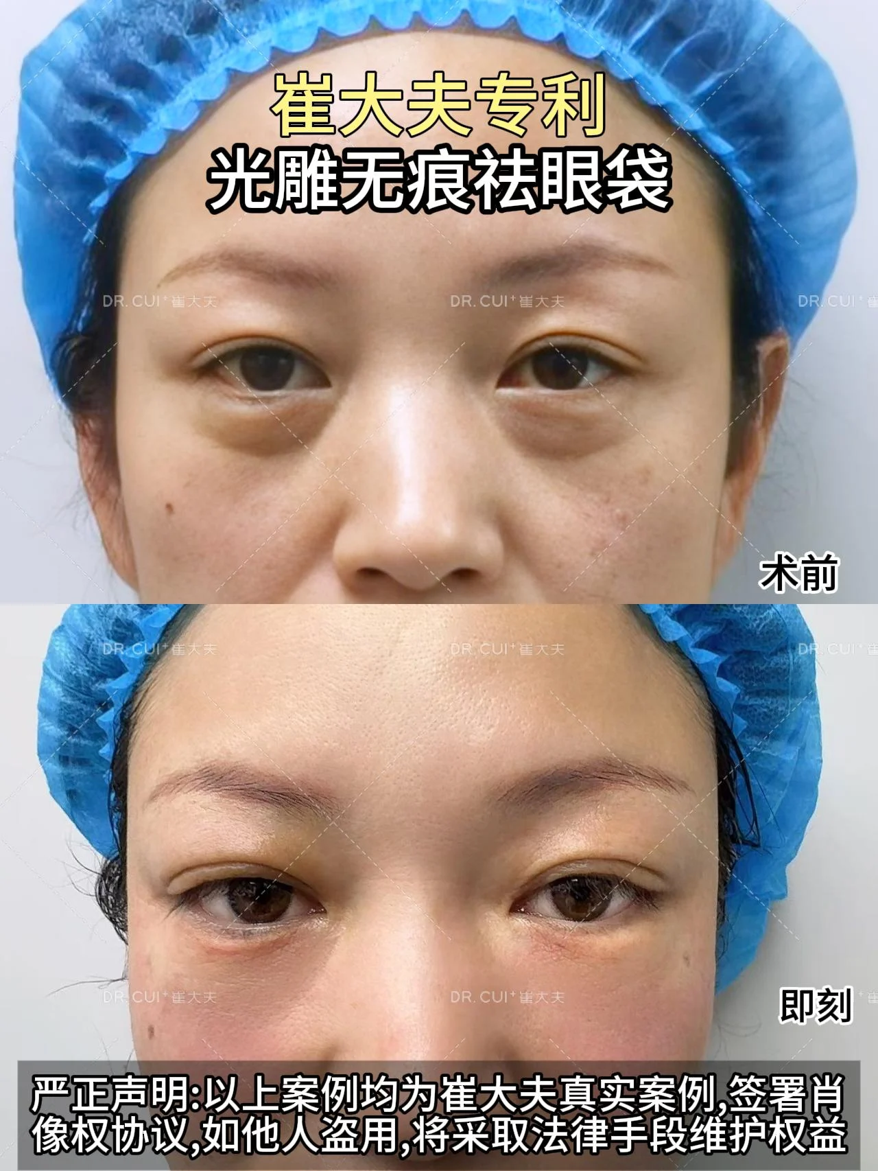对比 (24)