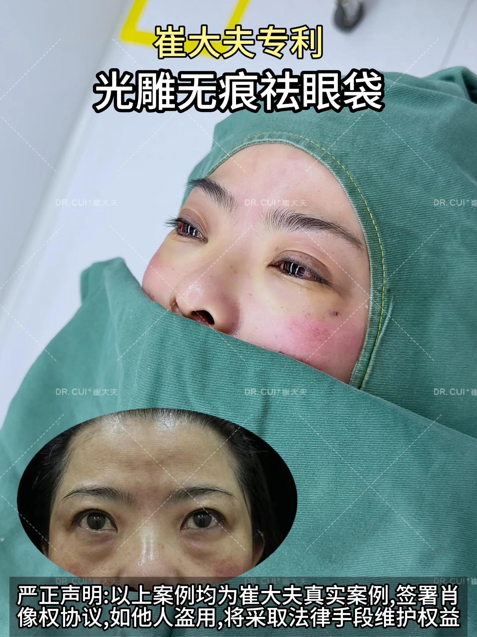对比 (25)