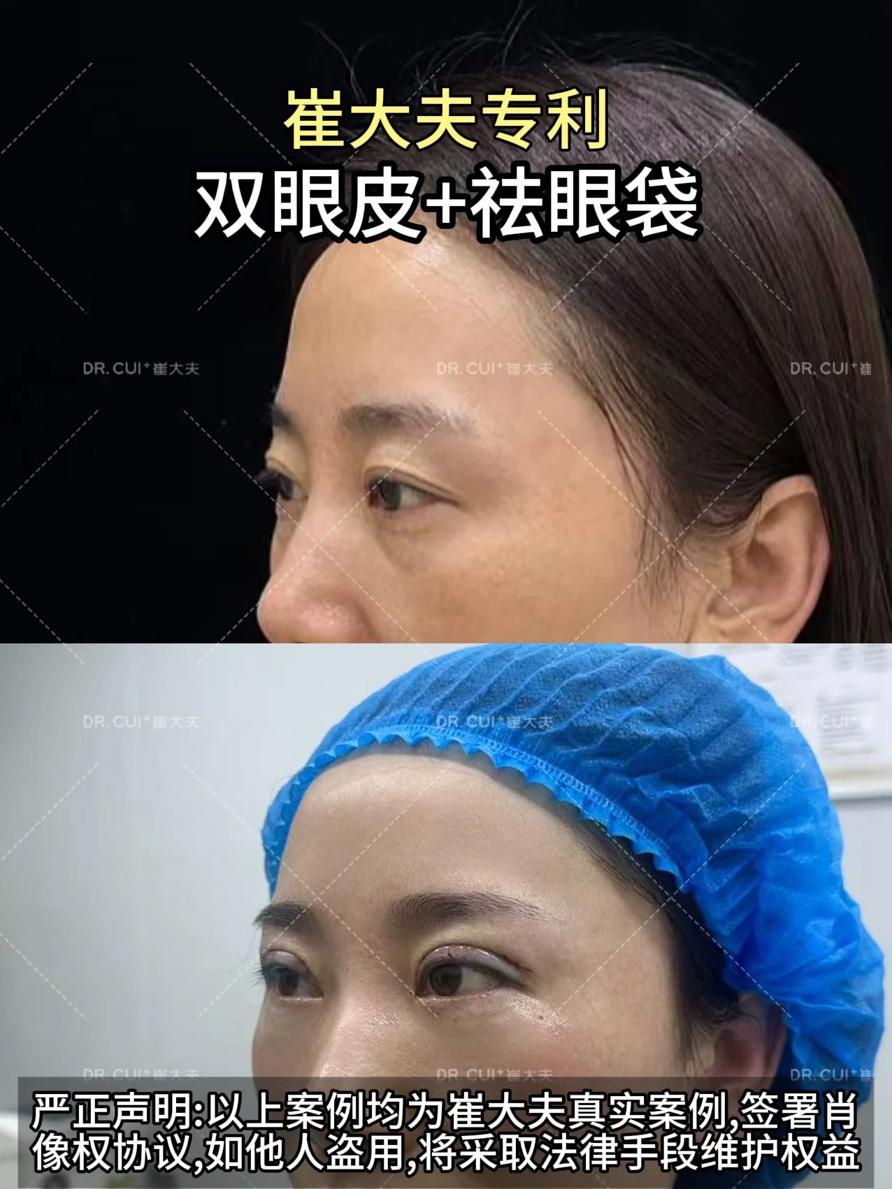 对比 (26)