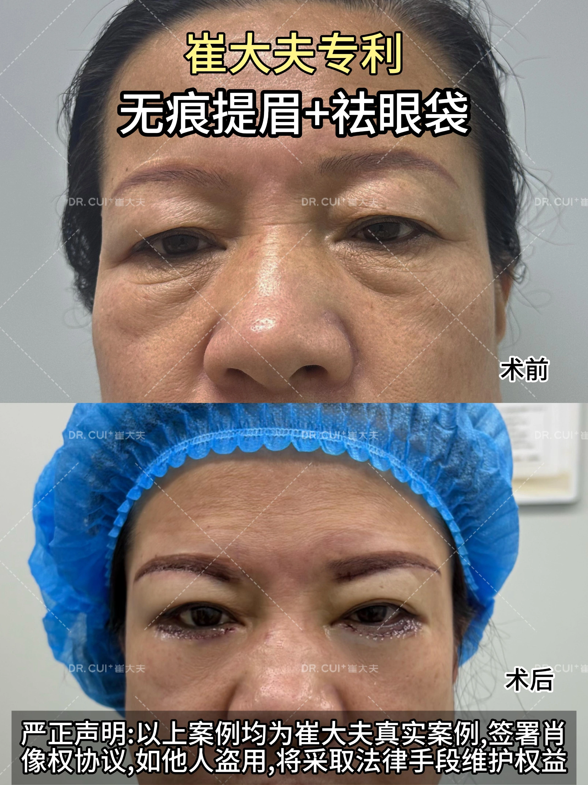 对比 (27)