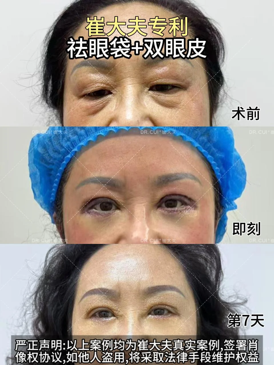 对比 (28)