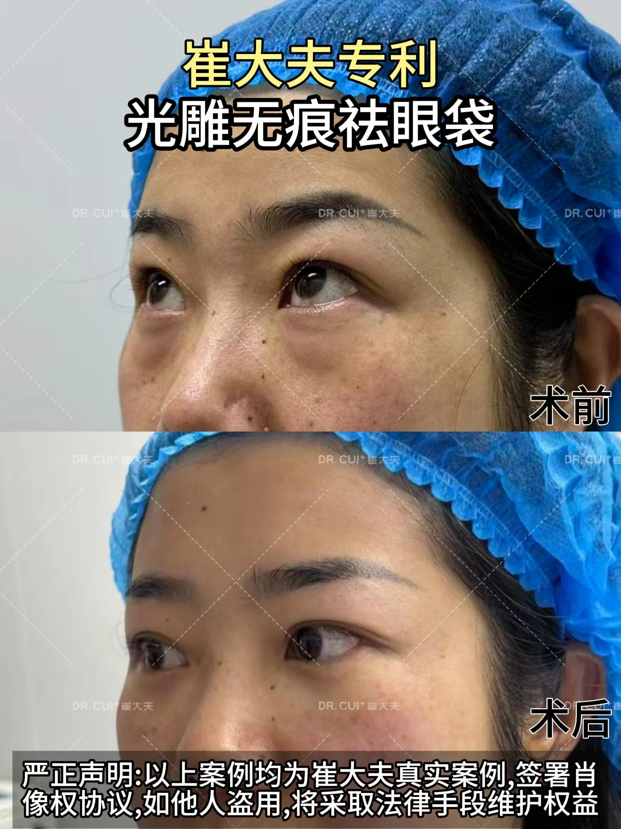 对比 (29)