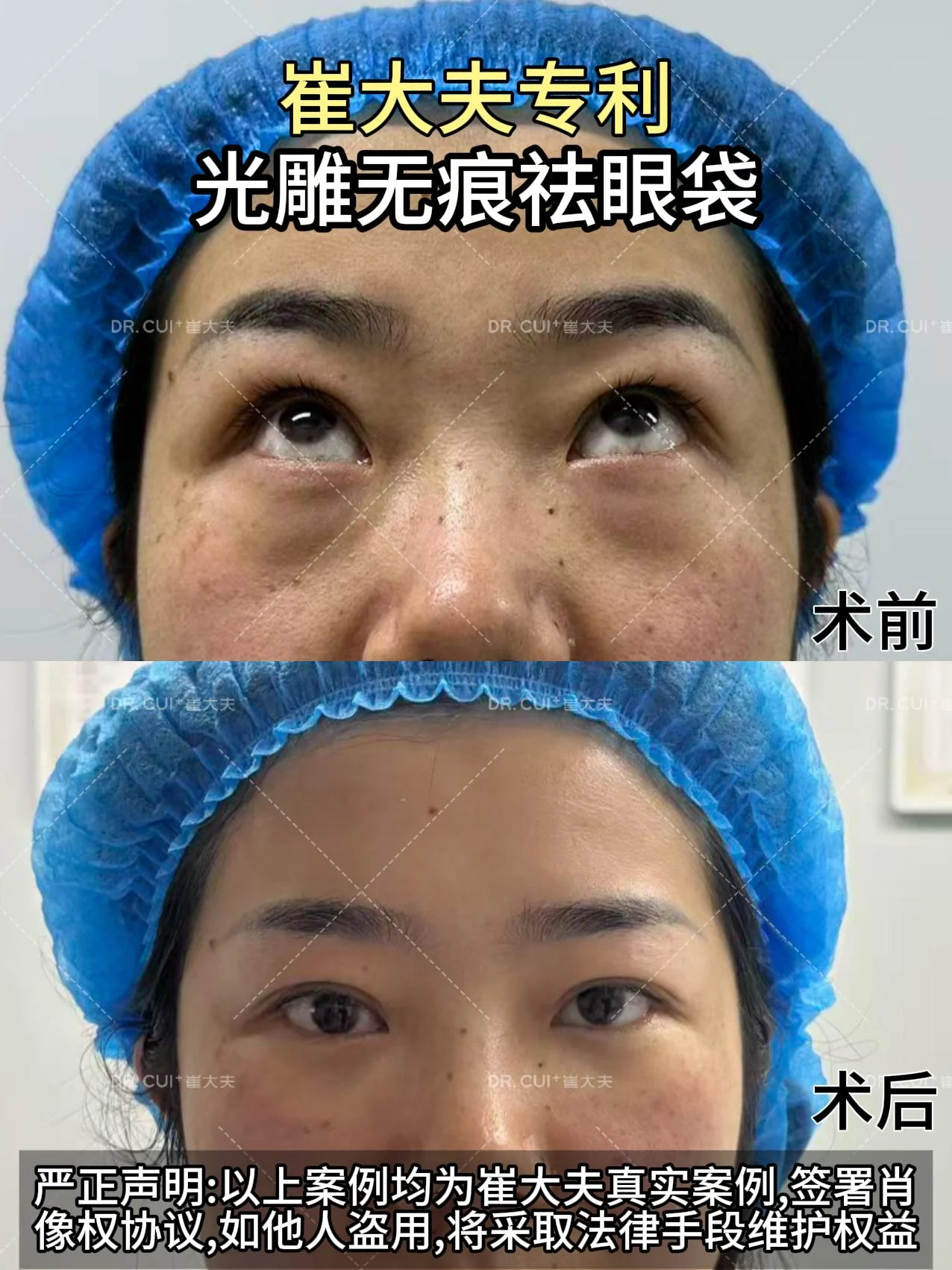 对比 (30)