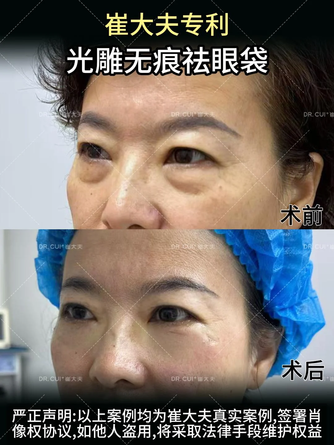 对比 (31)