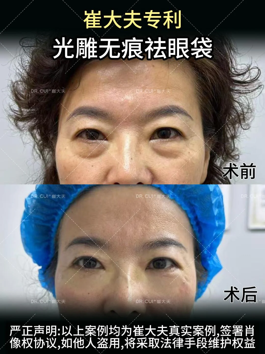 对比 (32)