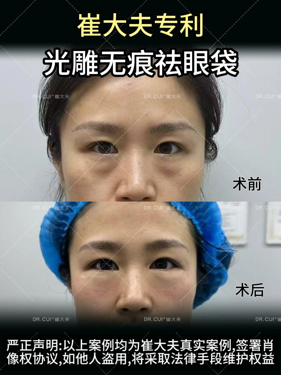 对比 (33)