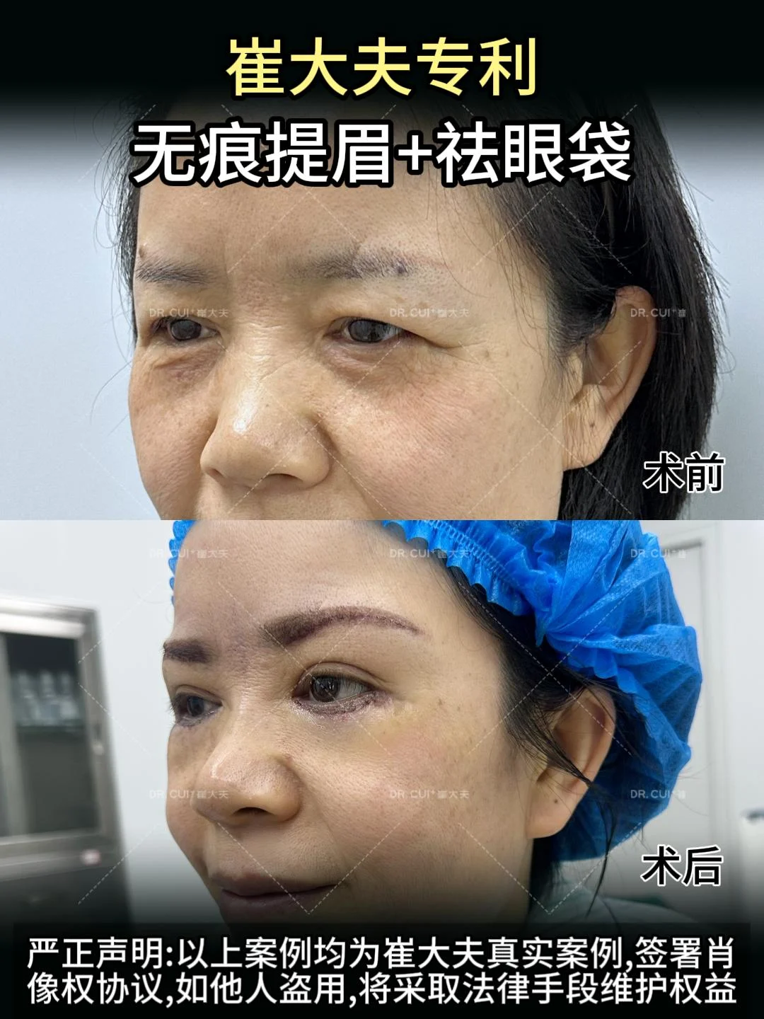 对比 (34)