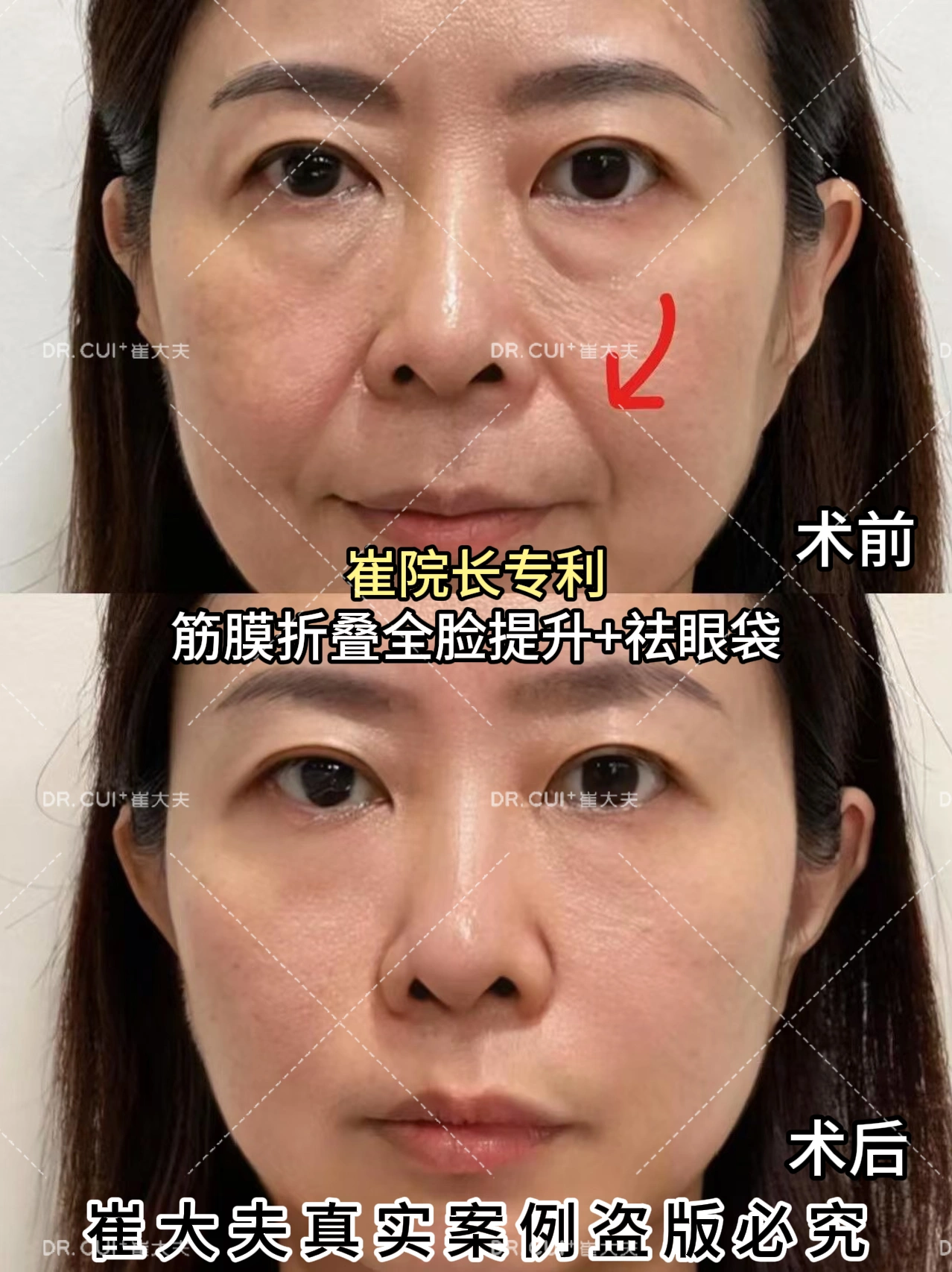 对比 (36)